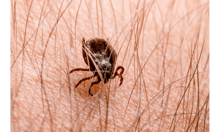 Lyme Disease Symptoms Treatment Diagnosis Aajkaakhbaar Health